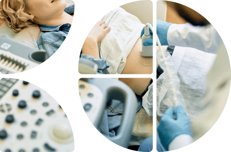 Sonografie des Bauchs 