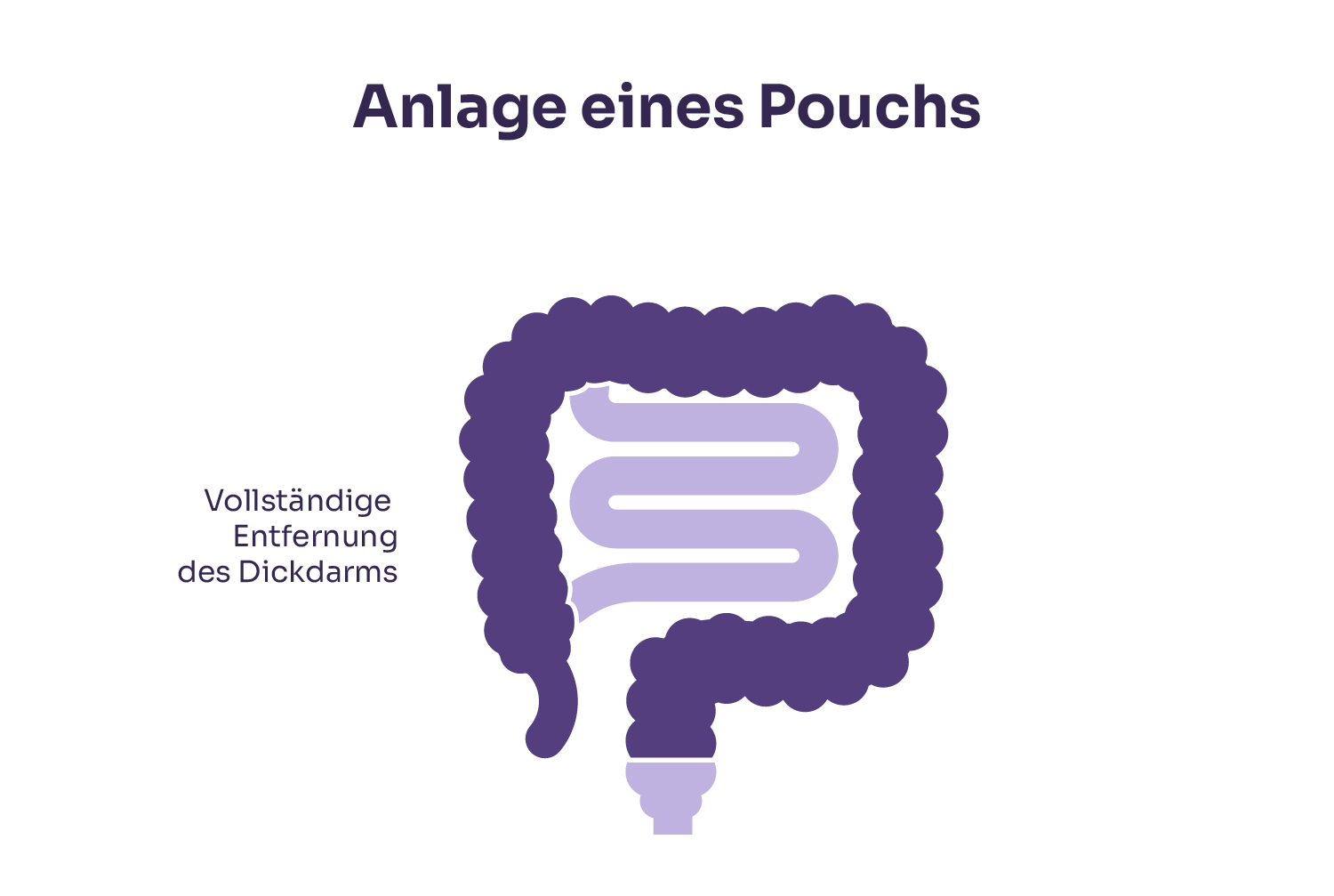 Anlage eines Pouchs