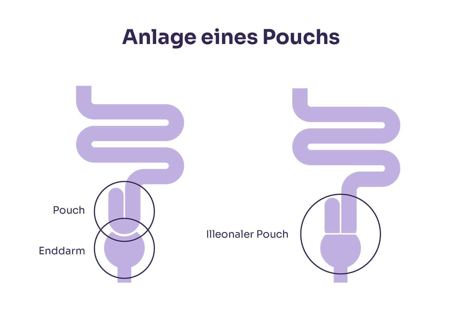 Anlage eines Pouchs