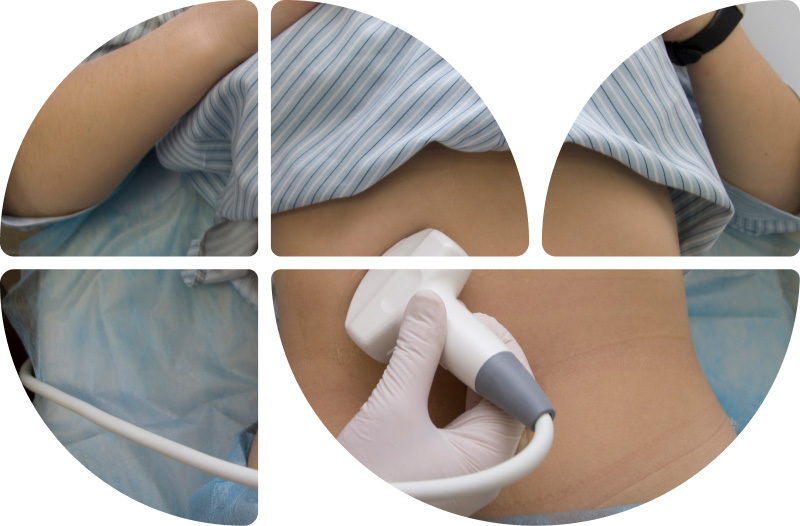 Ultraschalluntersuchung des Bauches