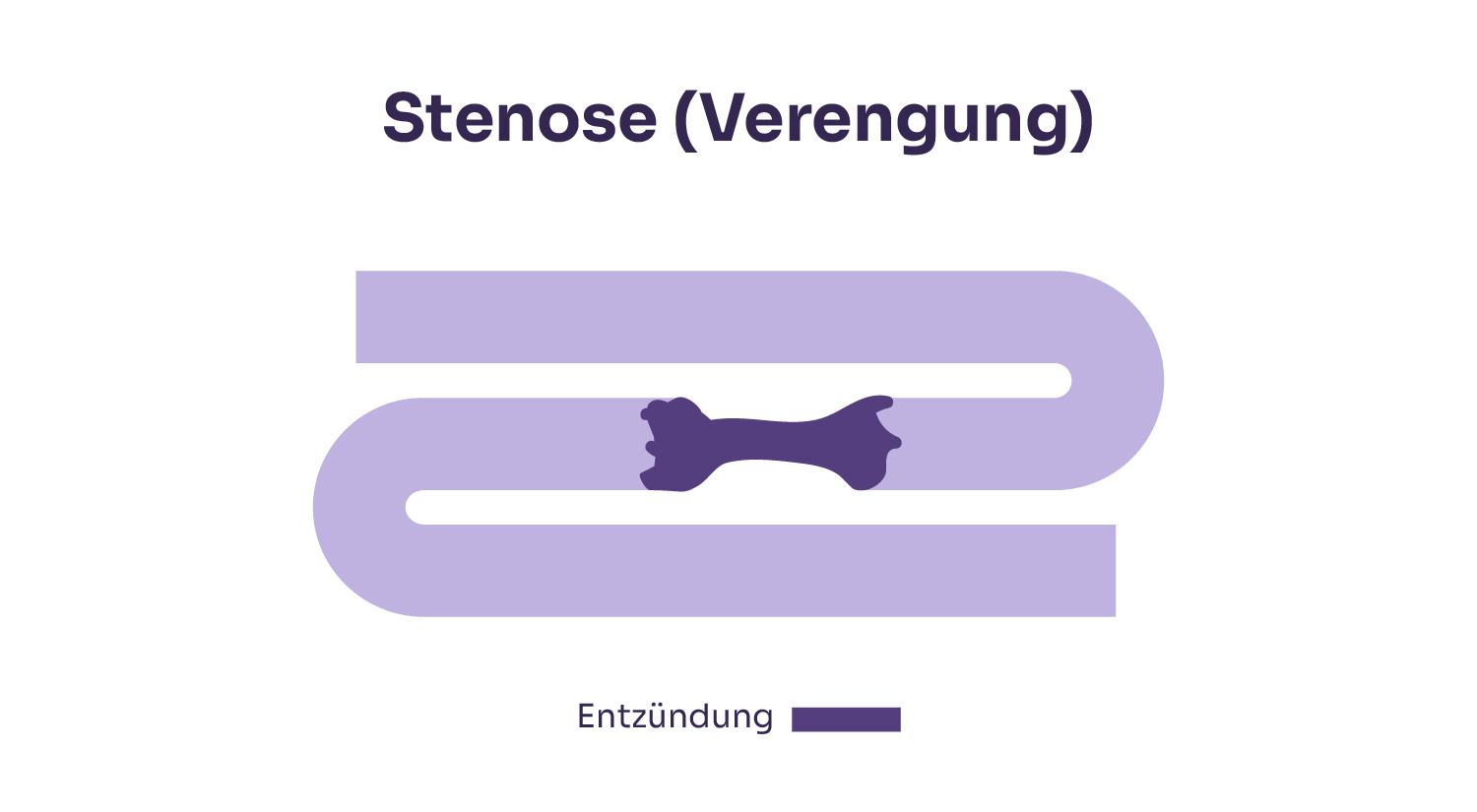 Stenose bei Morbus Crohn